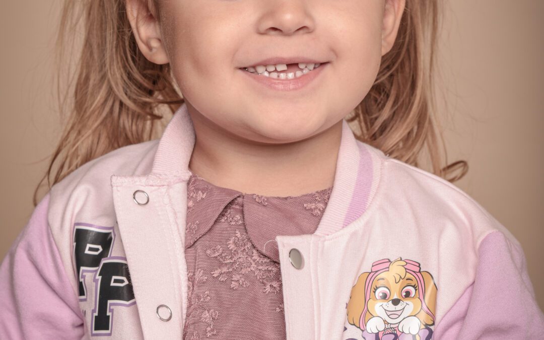 Merle Austria Schøn Lindborg